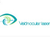 Visión Ocular Láser