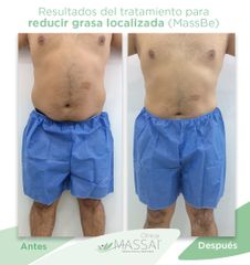 Reducción de Peso y Medidas - Massai Clínica