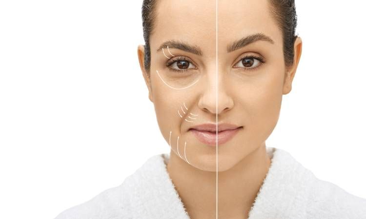 Antes y después tratamiento facial