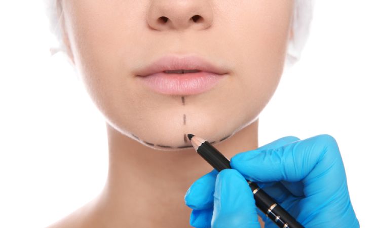 Cirugía de implantes de barbilla