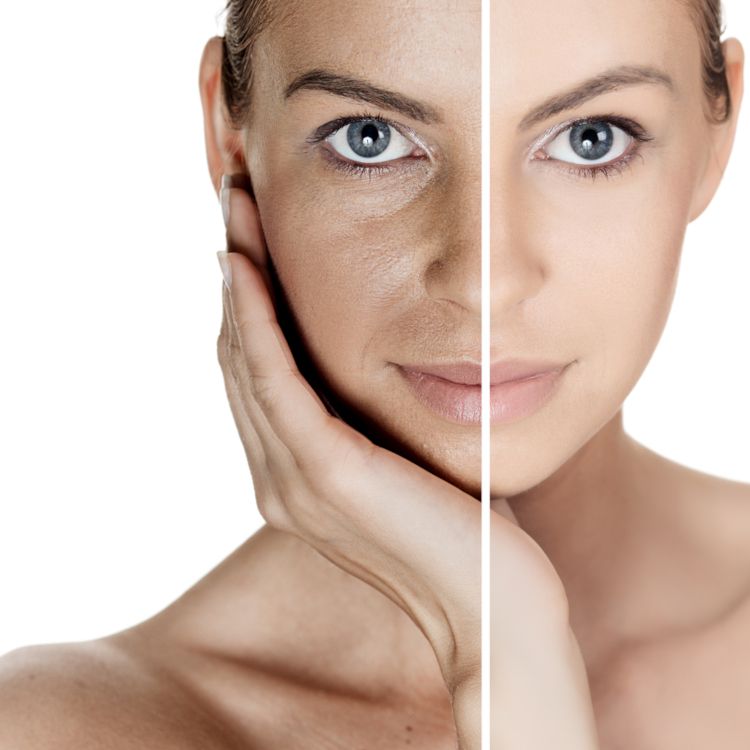 Rostro de mujer antes y después de un tratamiento dermatológico