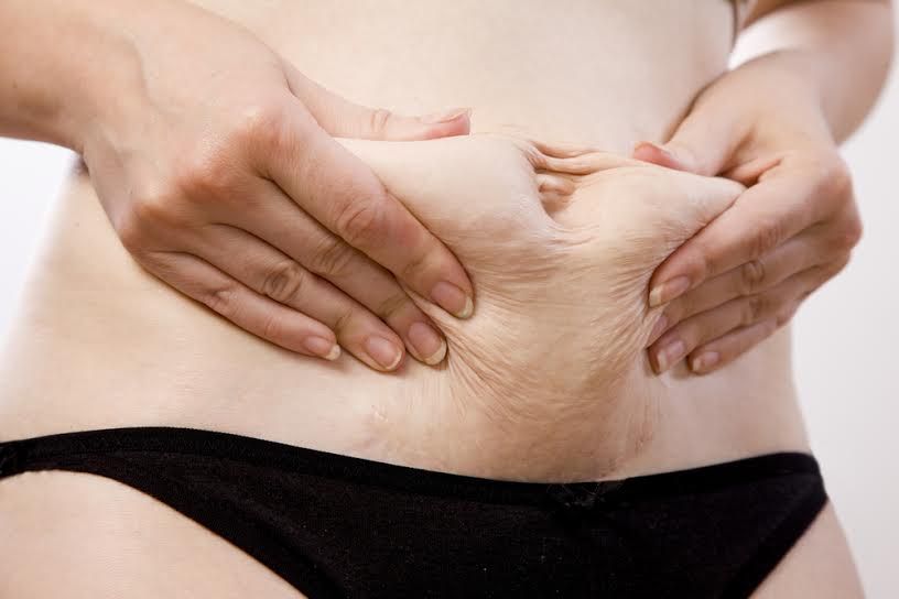 cómo recuperar la figura después del embarazo