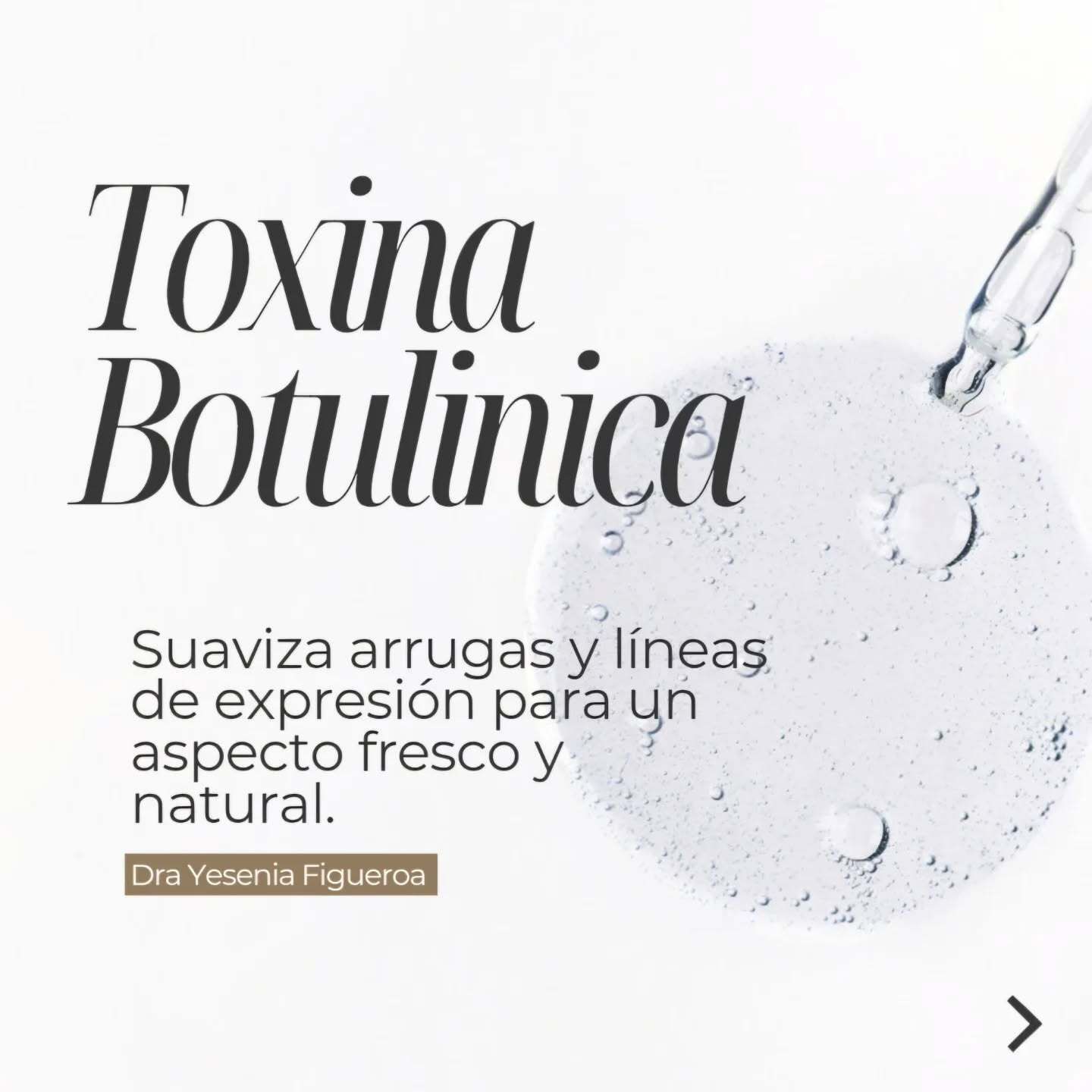 Toxina botulinica