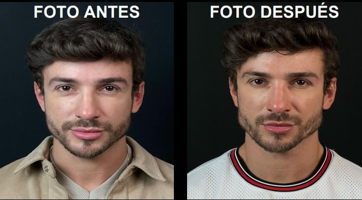 Antes y después de marcaje mandibular