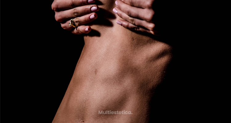 Definición y marcaje abdominal
