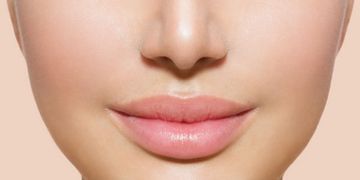Cirugía de labios,  una excelente opción para incrementar el volumen