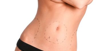 Liposuccion, el procedimiento y su tecnología. Liposuccion, el procedimiento y su tecnología.