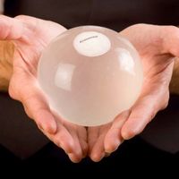 Balón intragástrico, una forma efectiva de perder peso