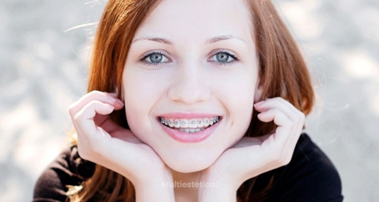 ​Brackets, un tratamiento mal hecho puede perjudicar la dentadura