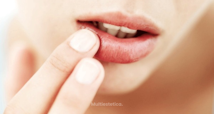 ​Queiloplastia, la cirugía clave para unos labios perfectos