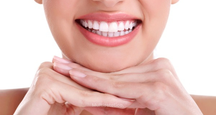 Necesito implantes dentales ¿Cómo decidirme?