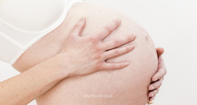 ¿Cuáles son los tratamientos estéticos para después del embarazo?