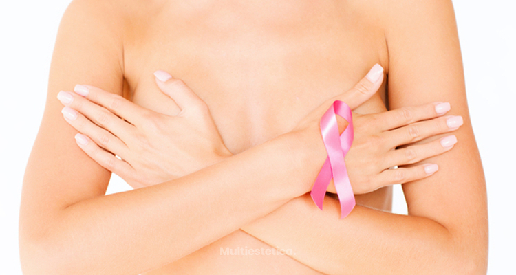 Mamografía con prótesis, todo lo que debes saber