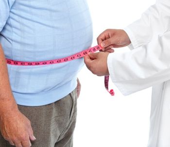 Manga gástrica: ¿una solución para la obesidad?