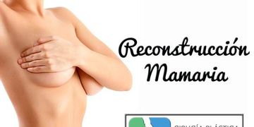 La reconstrucción mamaria