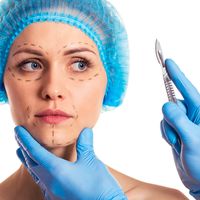 Conoce los tipos de Blefaroplastia