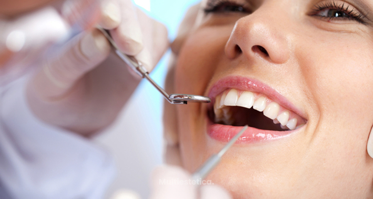 ¿Cómo funciona el blanqueamiento dental fotodinámico?