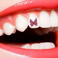 ​Tatuajes en los dientes ¿Se puede?