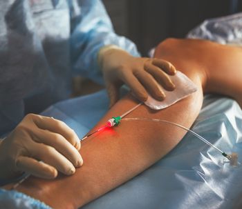 Elimina las varices con microespuma