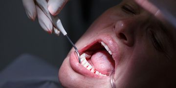 ​¿Cómo influye la diabetes en los problemas de salud bucal?