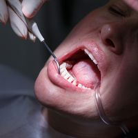 ​¿Cómo influye la diabetes en los problemas de salud bucal?