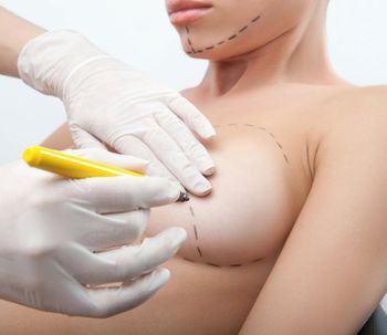 ¿Tienes el pecho caído? Mira lo que la mastopexia puede hacer por ti