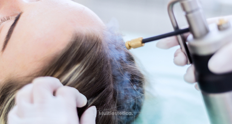 ​La crioterapia ayuda a reducir la pérdida de cabello tras las quimioterapias