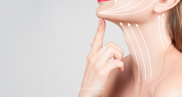 ​Belkyra: nuevo tratamiento para eliminar depósitos de grasa en el cuello