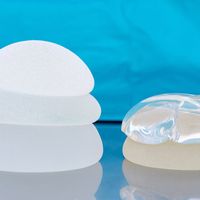 Pros y contras de los implantes de poliuretano