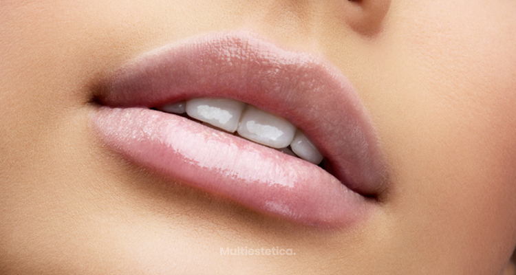 ¿​En qué consiste el aumento de labios?