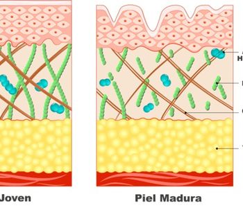 Uso Preventivo de Botox