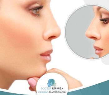 Rinoplastia con anestesia local