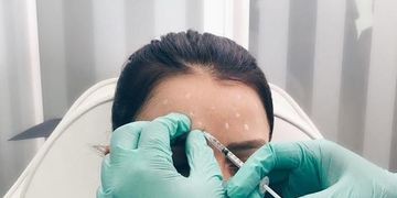 Bótox, ¿Qué es? ¿Para que sirve?