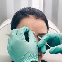 Toxina botulínica, ¿Qué es? ¿Para que sirve?