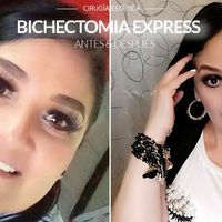 “Bichectomía express: adelgazamiento del rostro en 5 minutos”
