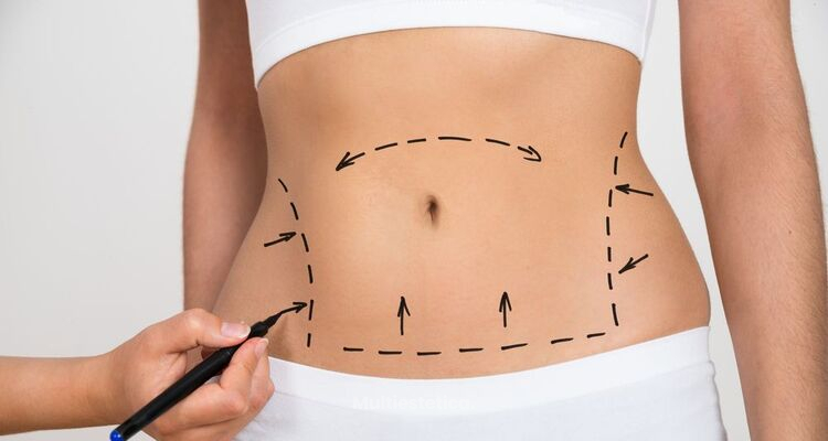 ¿Qué tratamientos debes de realizarte después de una cirugía estética?