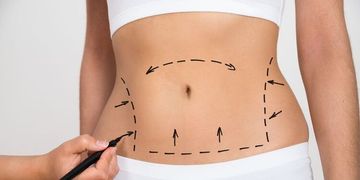 ¿Qué tratamientos debes de realizarte después de una cirugía estética?