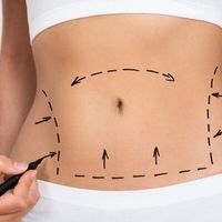 ¿Qué tratamientos debes de realizarte después de una cirugía estética?