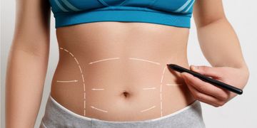 ¡Bye bye abdomen flácido! Descubre la maravilla de la abdominoplastia