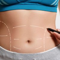 ¡Bye bye abdomen flácido! Descubre la maravilla de la abdominoplastia