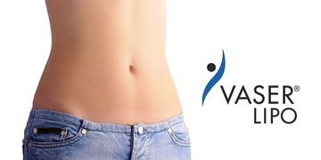Equipo Vaser para lipoescultura de alta definición: la revolución en el campo médico Equipo Vaser para lipoescultura de alta definición: la revolución en el campo médico