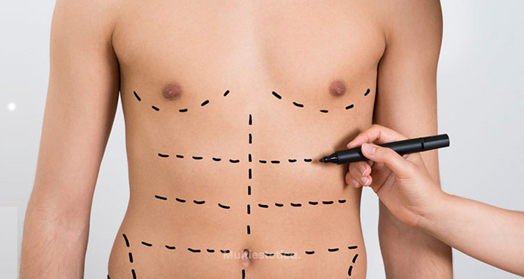 ¡Deslumbra con tu figura! Descubre la lipoescultura de alta definición