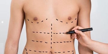¡Deslumbra con tu figura! Descubre la lipoescultura de alta definición ¡Deslumbra con tu figura! Descubre la lipoescultura de alta definición