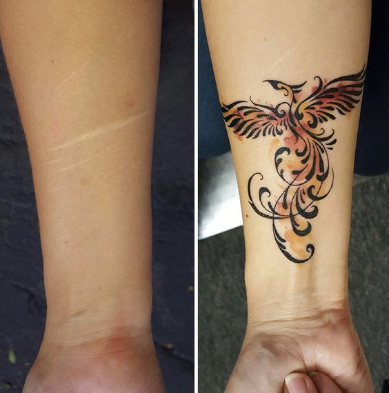 tatuajes-cicatrices.jpg