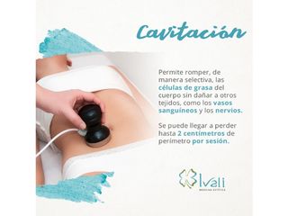 Cavitación 