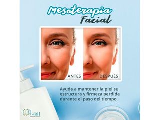 Mesoterapia facial