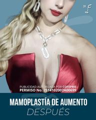 Aumento de busto - Dr. Francisco Forasté