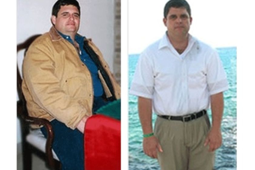 Manga Gástrica antes y después - 498834