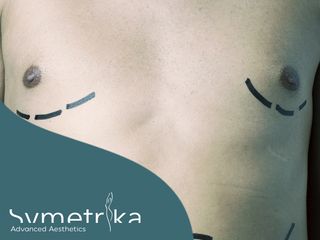 Symetrika Advanced Aesthetics 