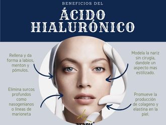 Ácido hialurónico - 648563